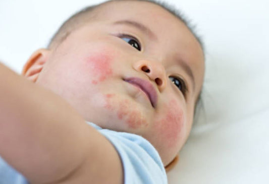 Jak sobie radzić z AZS u dziecka