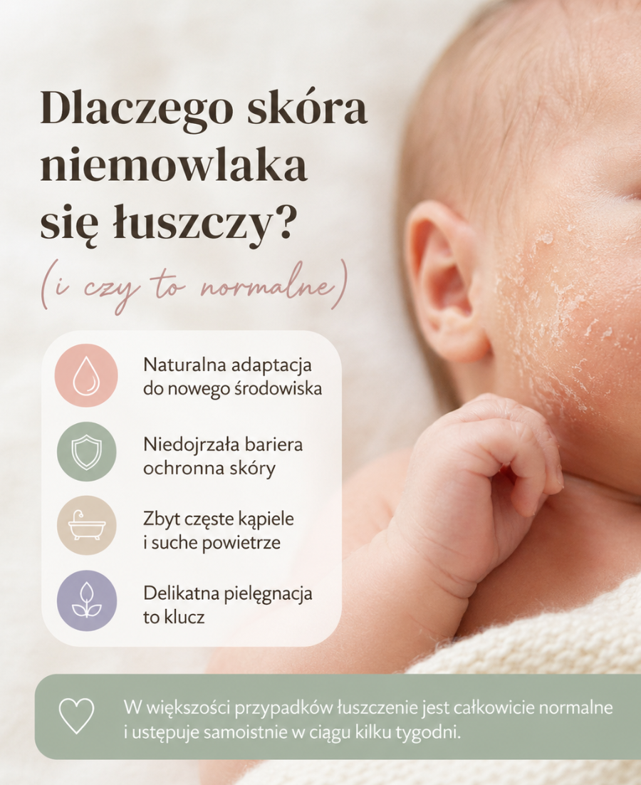 Dlaczego_skora_niemowlaka_sie_luszczy.